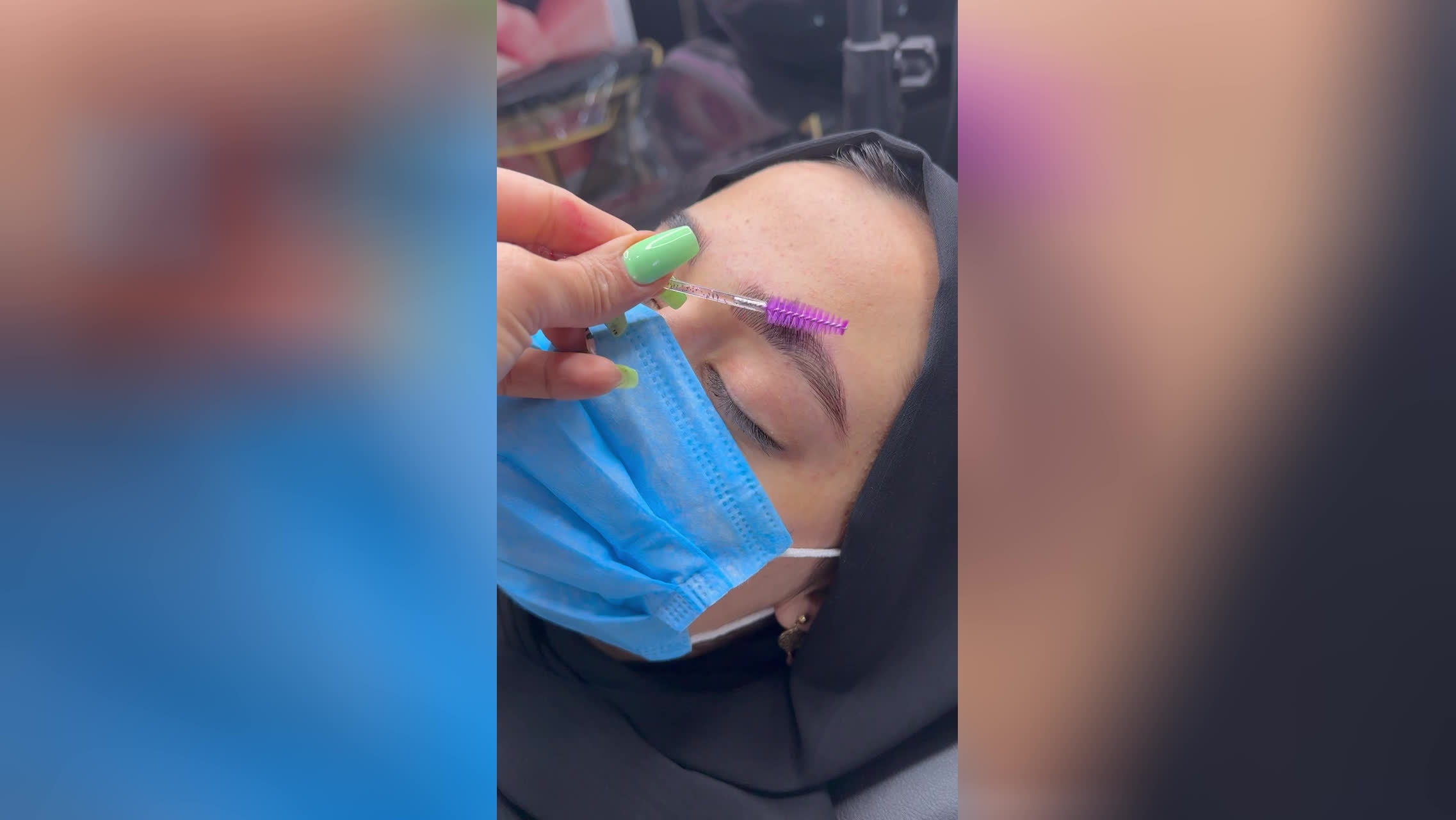 خدمات شیدینگ لب در تهران